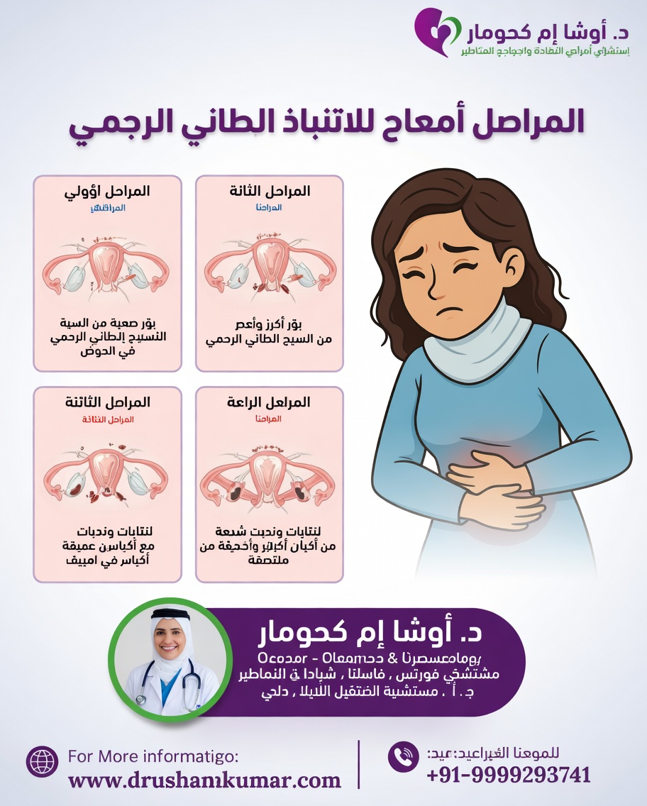 ما الذي يجب على كل امرأة معرفته عن الانتباذ البطاني الرحمي