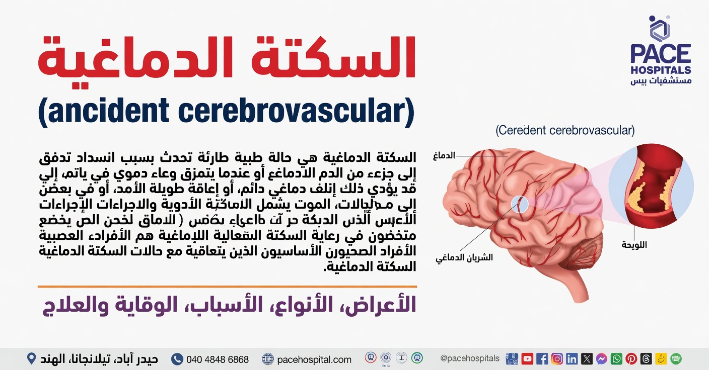 هل يمكن أن يكون هذا العرض أثناء النوم علامة تحذيرية على السكتة الدماغية؟