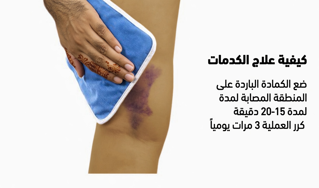 ماذا يعني لون الكدمة لديك؟ تحذير قد يكون جسمك يرسله