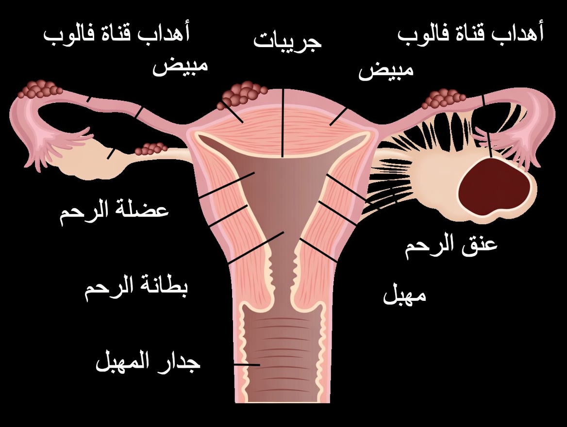 تحذير بشأن الانتباذ البطاني الرحمي: عادات يومية يجب ألا تتجاهليها