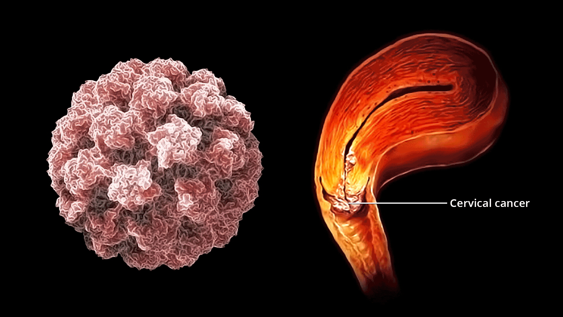 الأعراض الخطيرة لسرطان عنق الرحم التي يجب على كل امرأة معرفتها وعدم تجاهلها أبدًا