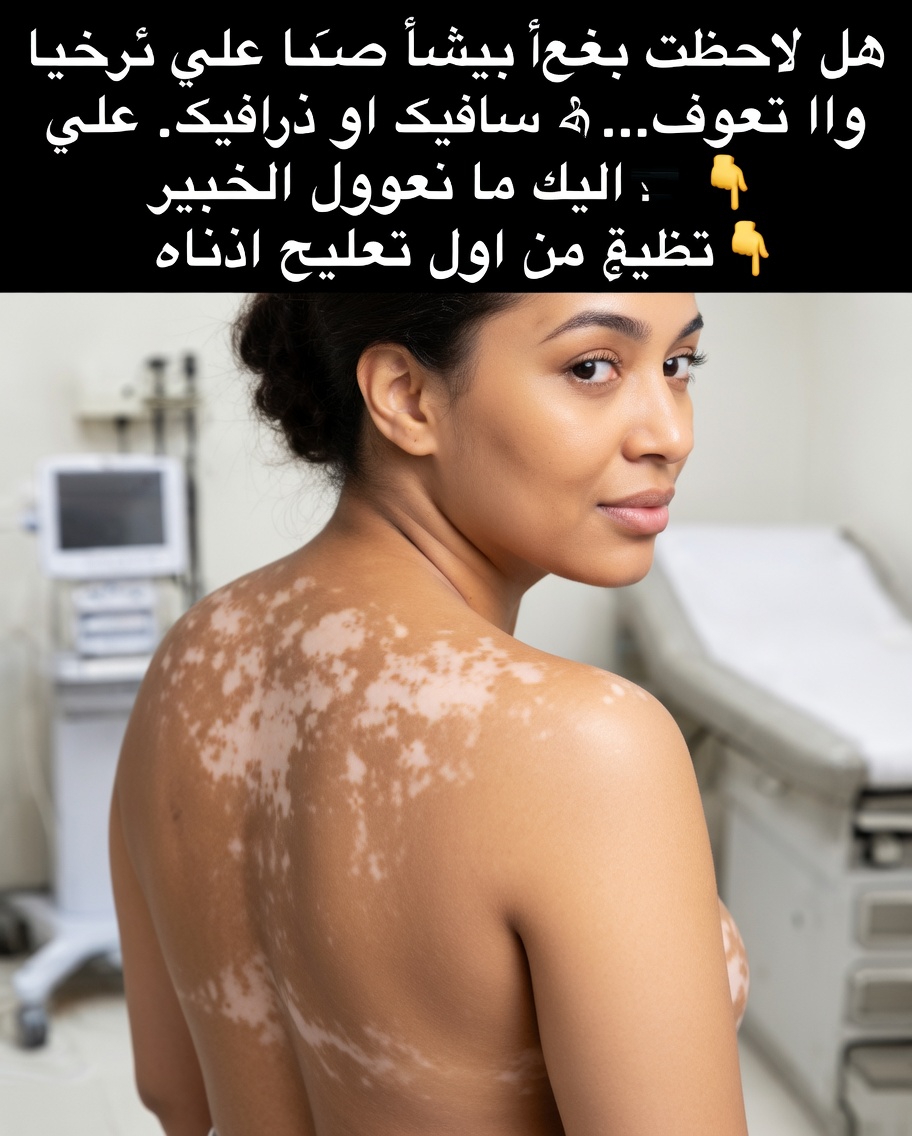 تلك البقع البيضاء الصغيرة على ذراعيك وساقيك وظهرك: ما تحتاج إلى معرفته عن هذا التغير الجلدي الشائع