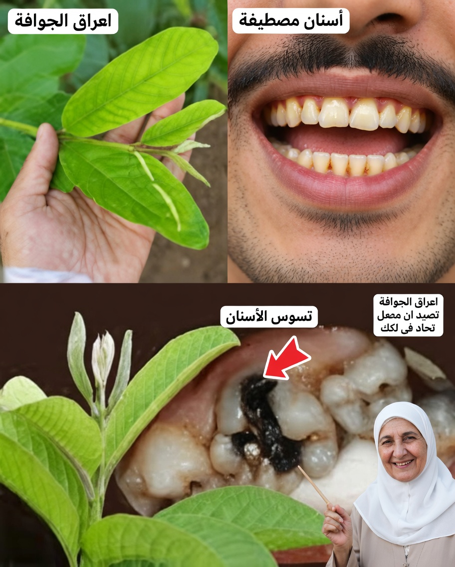 أفضل 3 طرق لعلاج تسوس الأسنان بأوراق الجوافة – بسيطة وفعالة من حيث التكلفة