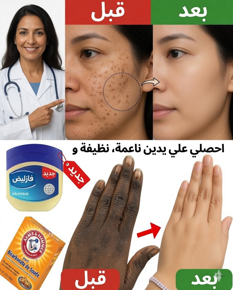 قناع منزلي ليدين ناعمتين وملساء وأكثر شبابًا بشكل ملحوظ