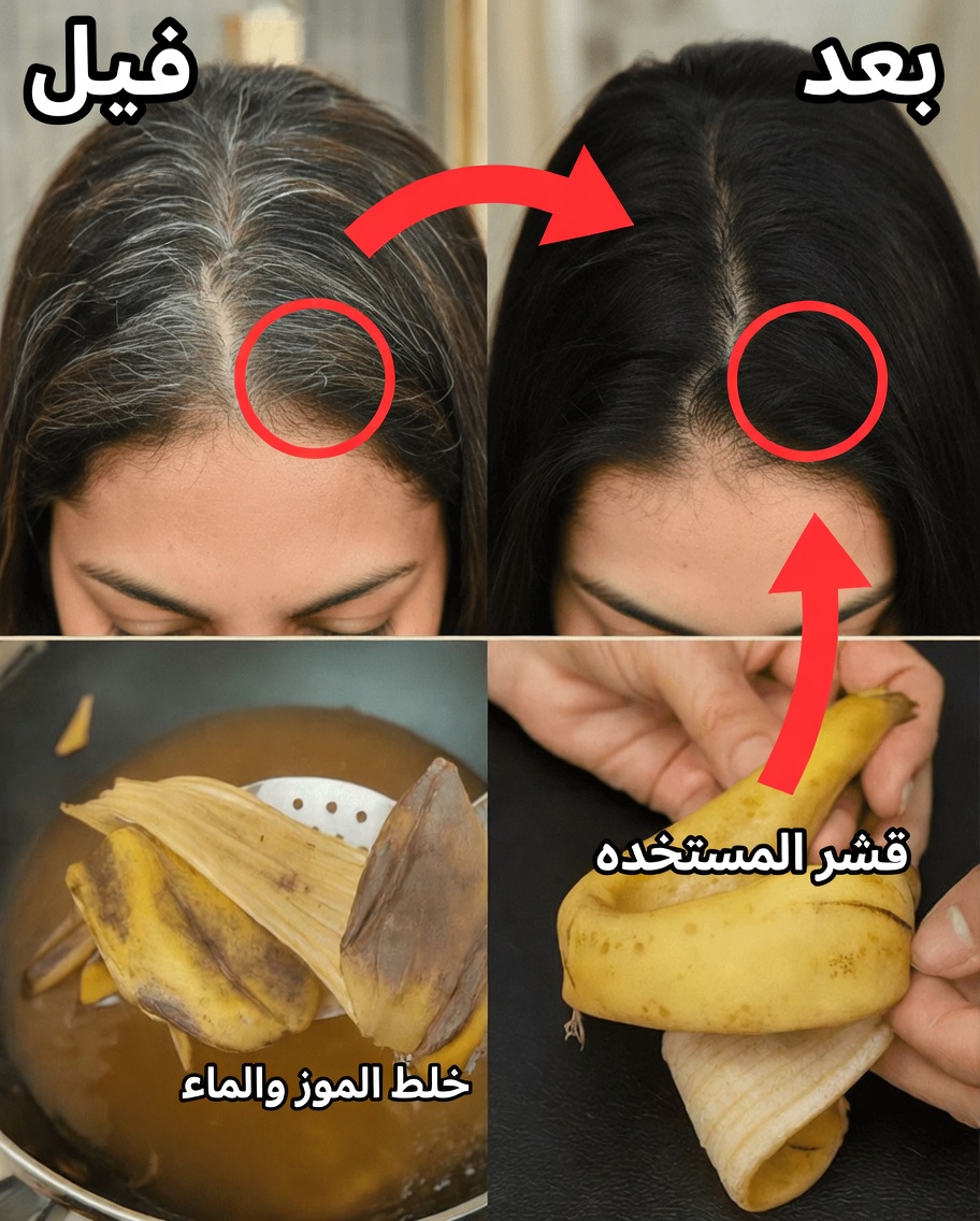 اكتشف القوة الخفية لقشور الموز للحصول على شعر أكثر صحة وقوة