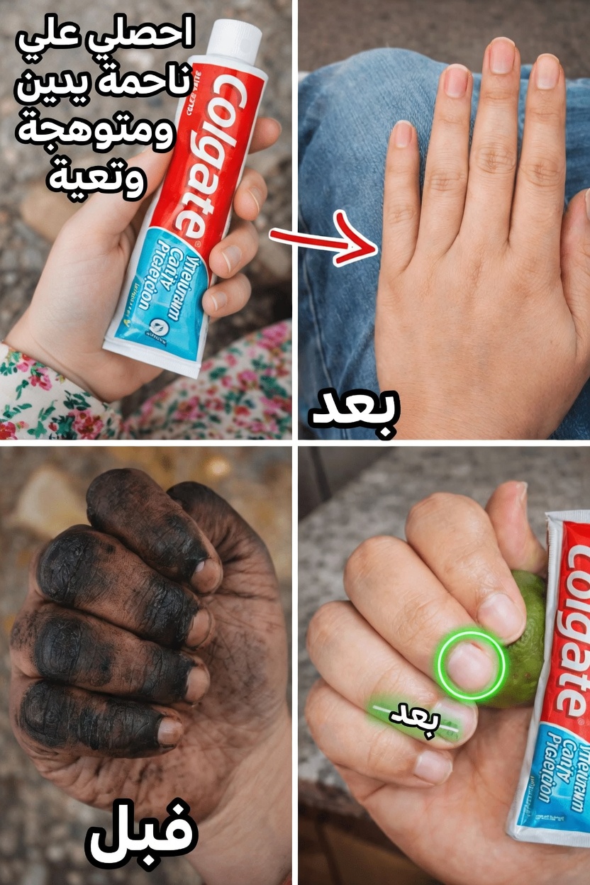 طرق طبيعية للمساعدة على تلاشي اسمرار الشمس على اليدين وكشف بشرة أكثر نعومة