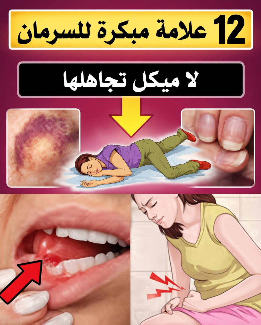 10 علامات تحذيرية لسرطان الثدي لدى النساء يجب ألا تتجاهليها أبدًا وأن تستشيري الطبيب بشأنها دائمًا