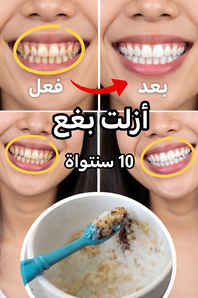 لماذا تحدث التصبغات السطحية ولماذا يهم التلميع اللطيف