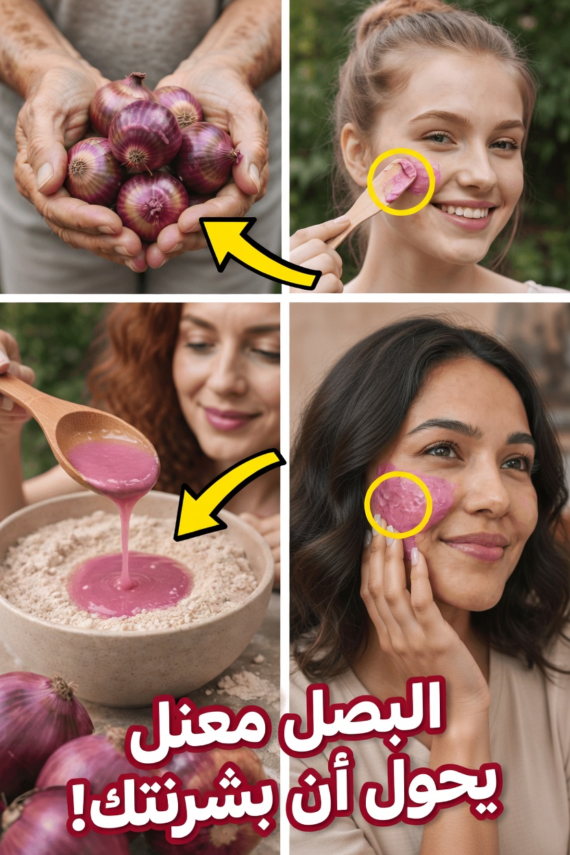قناع الوجه بعصير البصل: السر الطبيعي للعناية بالبشرة الذي يجربه الناس للحصول على بشرة أكثر إشراقًا ونعومةً في المظهر