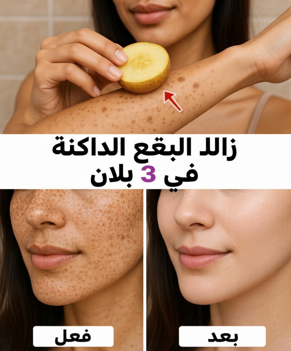 تخلّص من البقع العمرية والكلف وبقع الشمس والعيوب وعلامات الشيخوخة