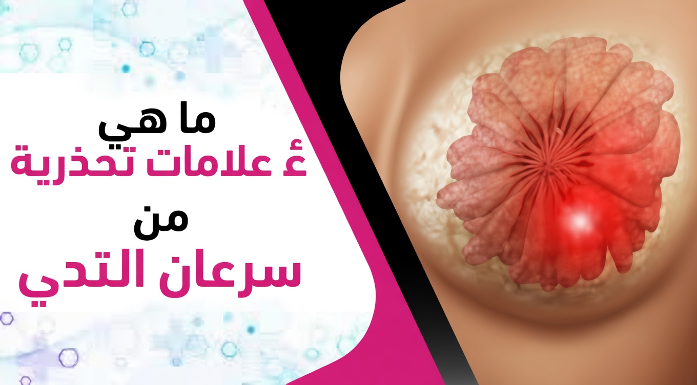 ٤ علامات مبكرة لسرطان الثدي يجب أن تعرفها كل امرأة