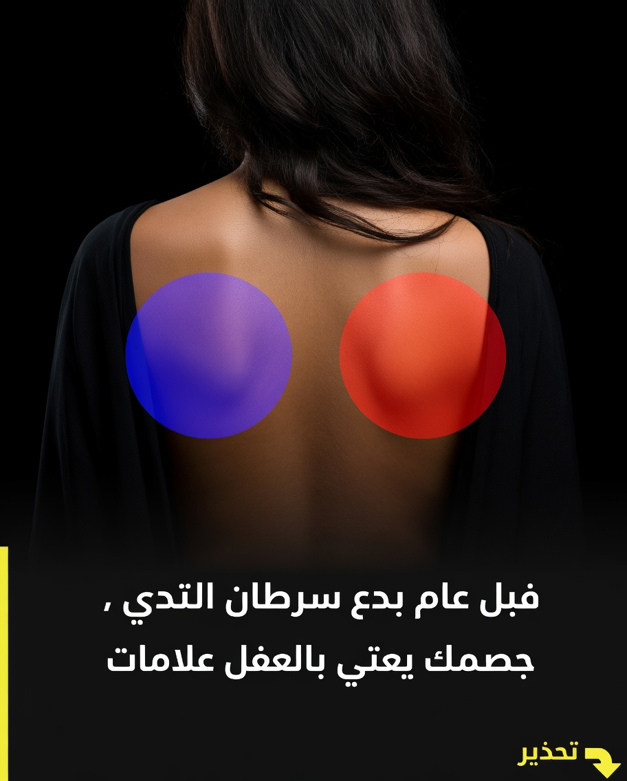 ٤ علامات مبكرة لسرطان الثدي يجب أن تعرفها كل امرأة