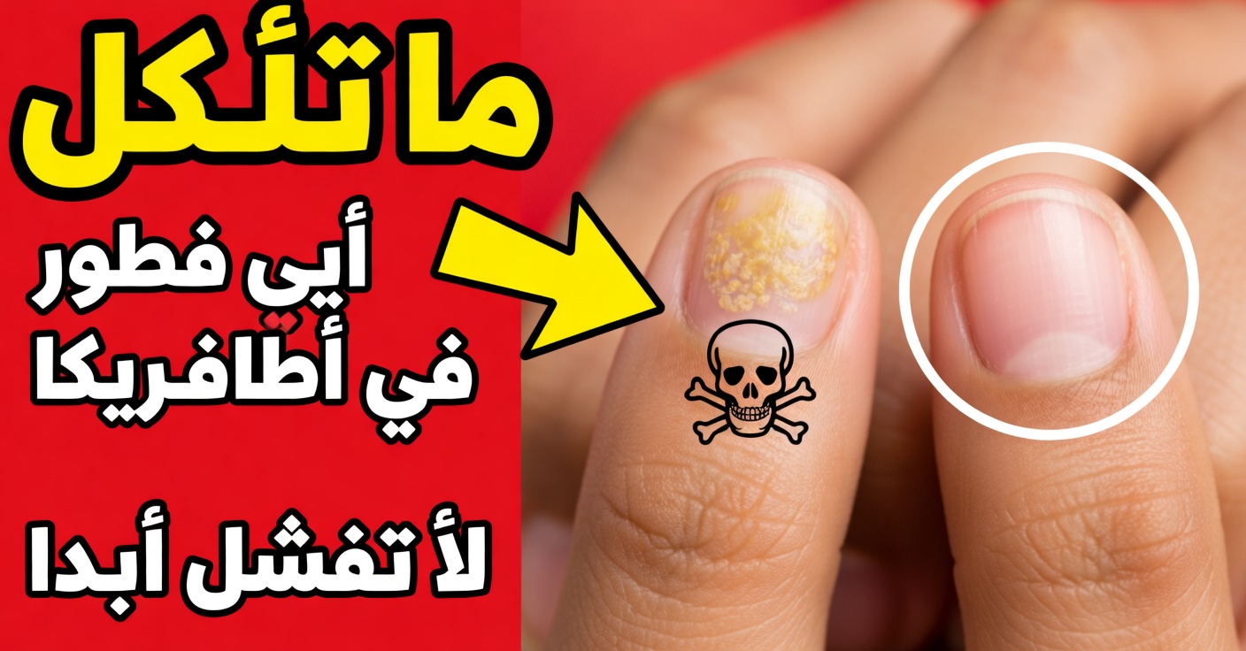 الخل لفطريات الأظافر