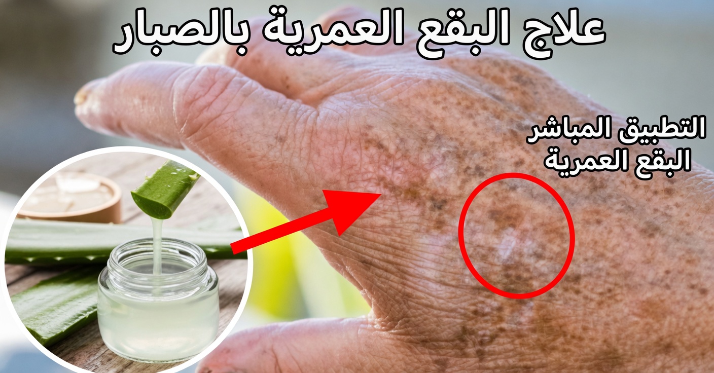 كيفية إزالة البقع من اليدين