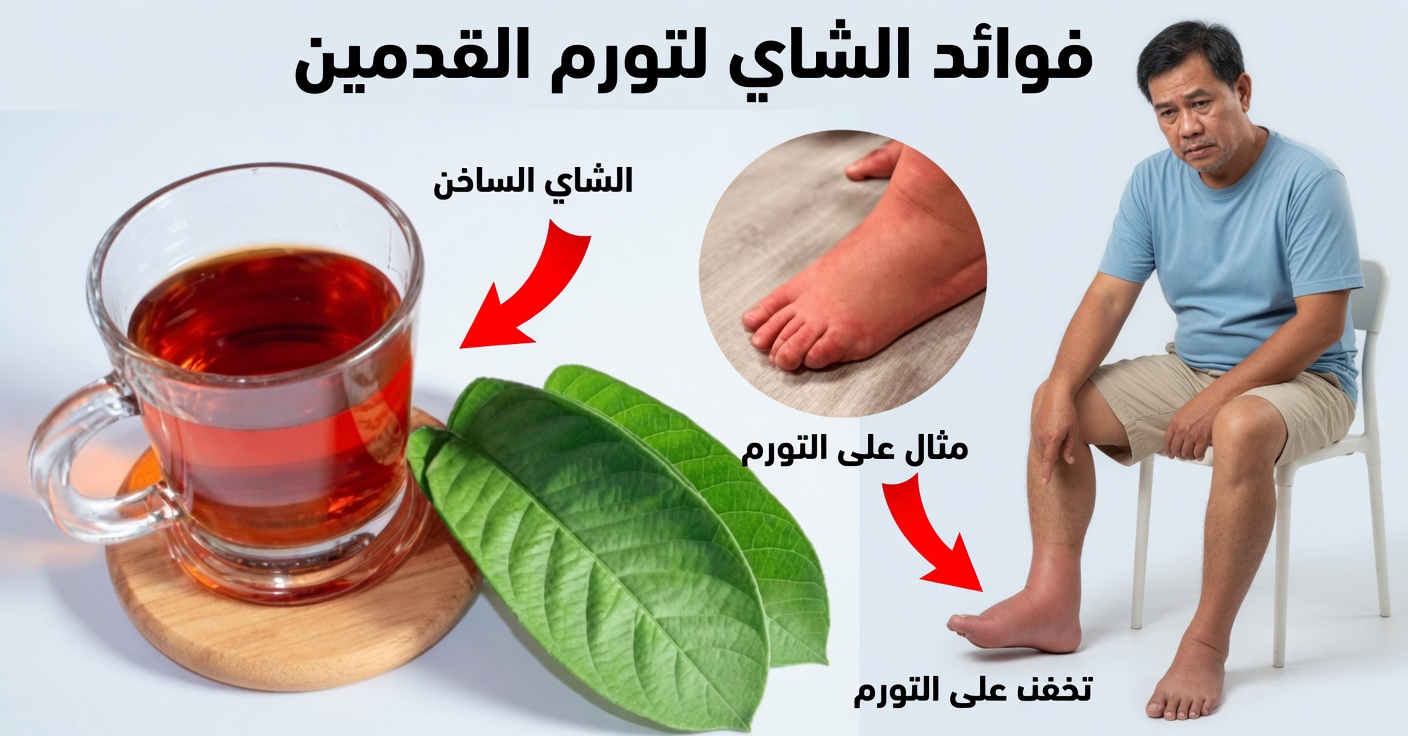 شاي الجوافة لاحتباس السوائل: راحة طبيعية