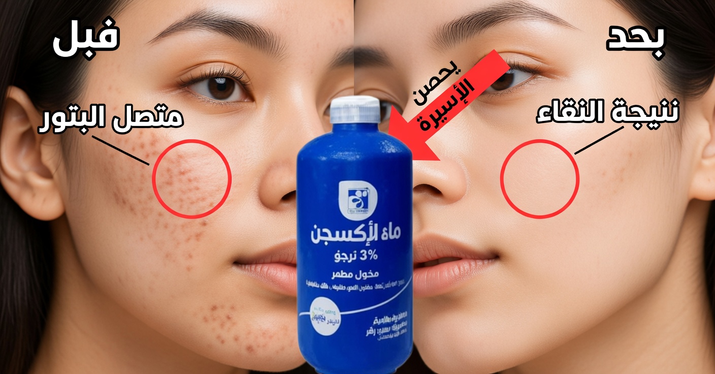 ماء الأكسجين للبقع والتجاعيد: كيفية استخدامه على البشرة