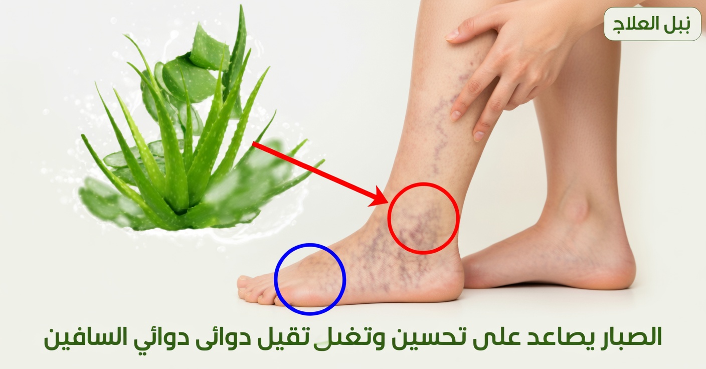 الألوفيرا للدوالي والساقين المتعبتين: علاج طبيعي