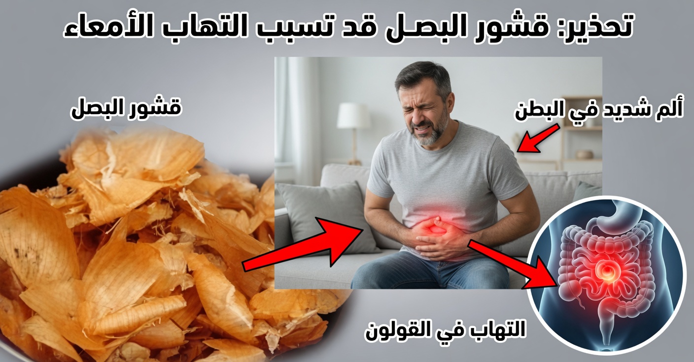 البصل والقشور: علاجات للبروستاتا والمثانة