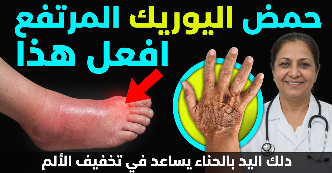 8 علاجات طبيعية لخفض حمض اليوريك