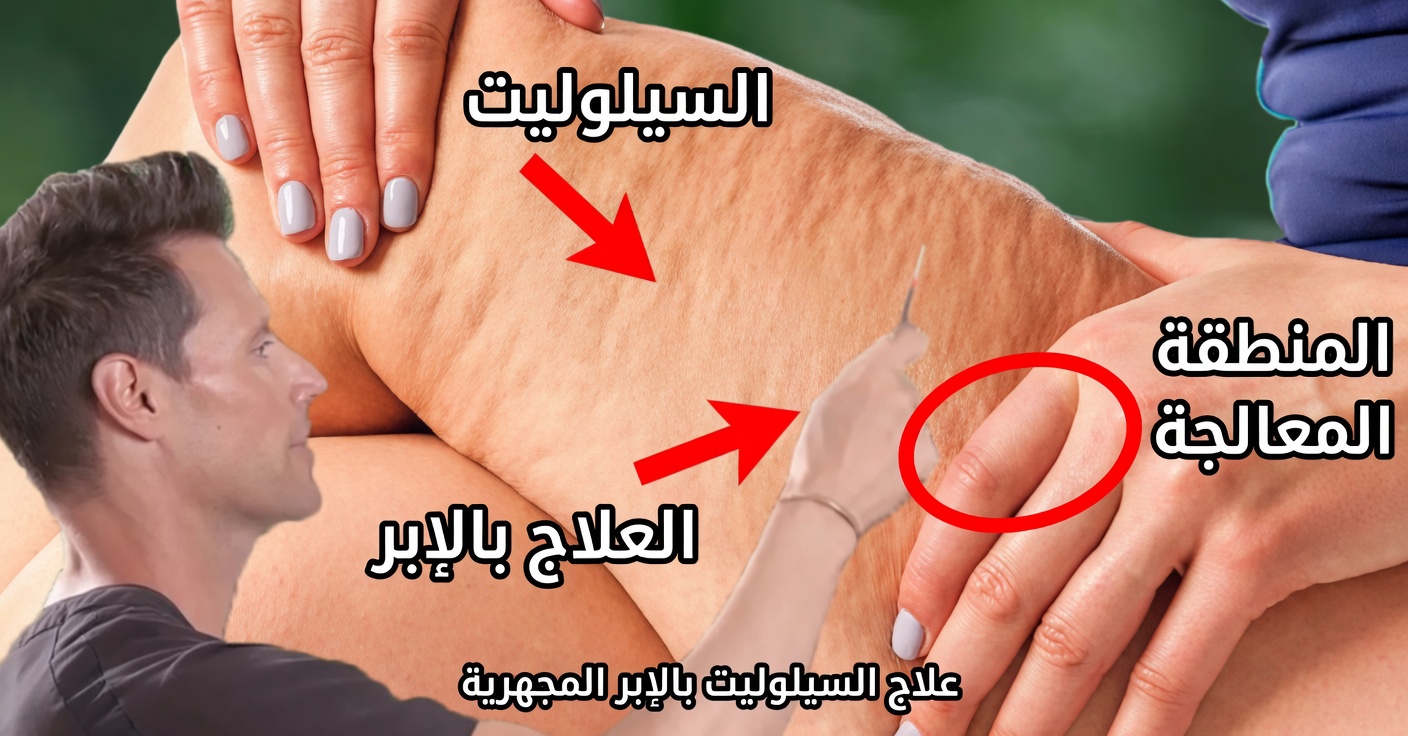 اكتشف الفوائد الطبيعية لشاي الكركديه في إنقاص الوزن