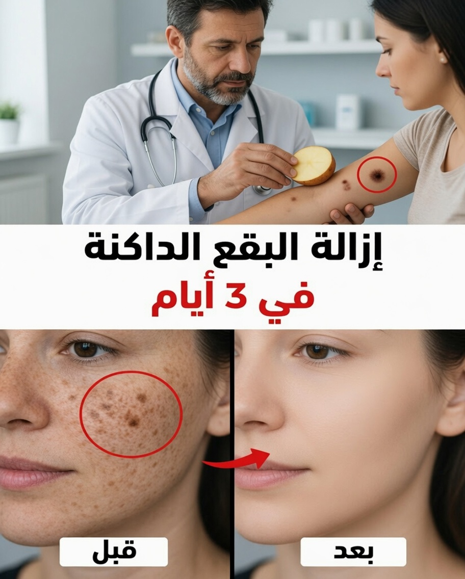 9 طرق طبيعية للمساعدة في تقليل بقع التقدم في السن، والكلف، والبقع الشمسية، وعلامات الشيخوخة
