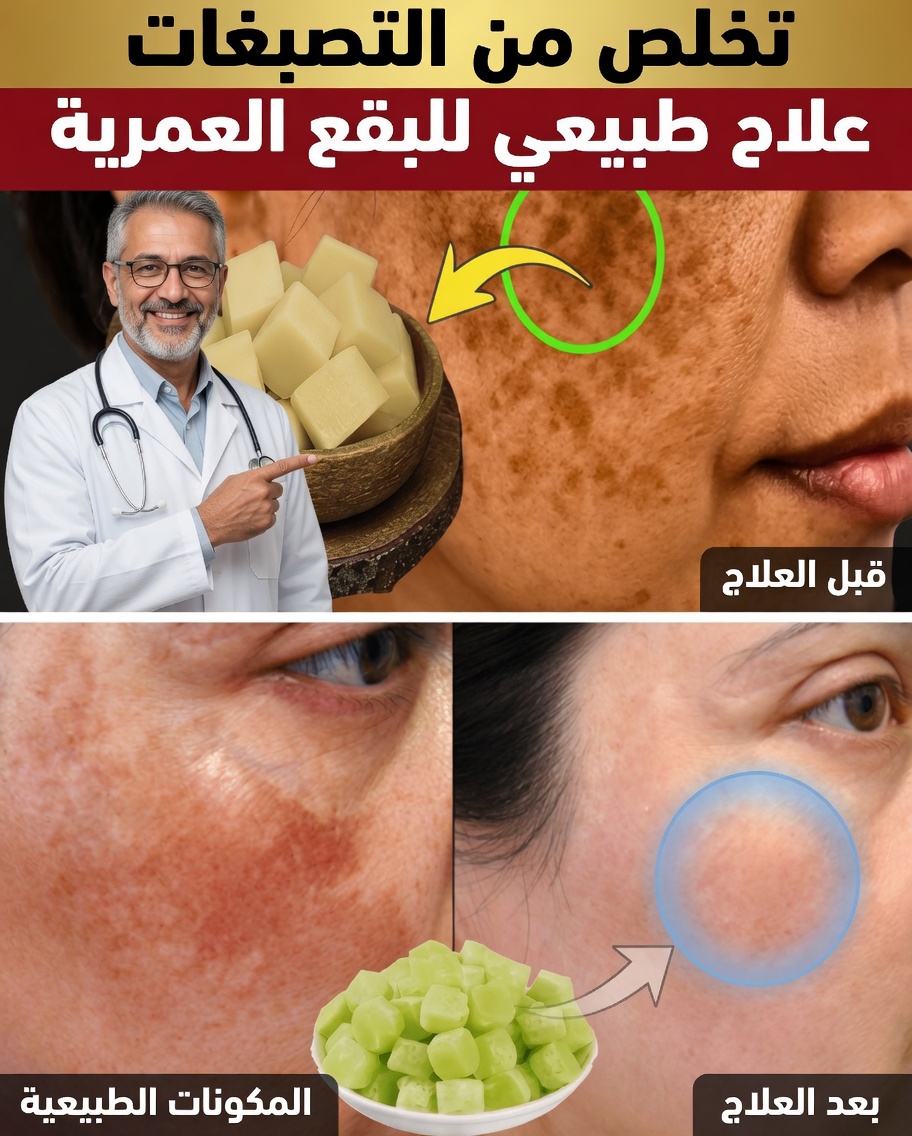 امحُ التصبغات والكلف والبقع الداكنة طبيعيًا خلال 20 يومًا فقط – مستوحى من حكمة طول العمر اليابانية
