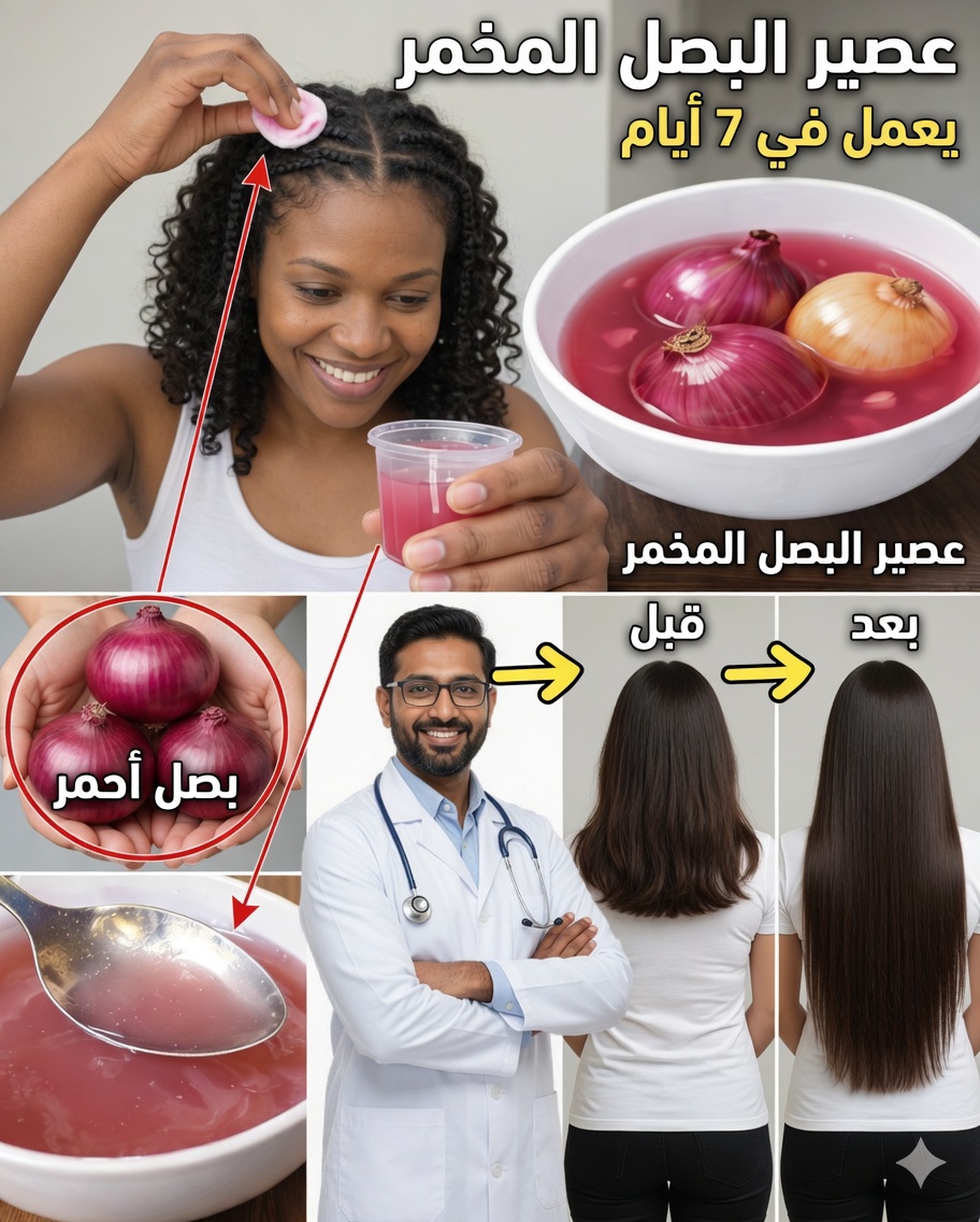 عصير البصل المُخمَّر: السرّ الطبيعي لشعر أكثر كثافة وقوة ونمو أسرع