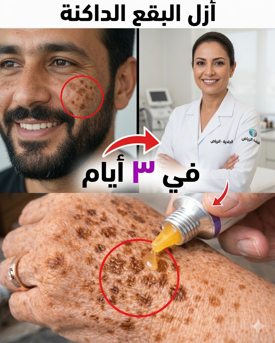 تخلّصي من بقع التقدّم في السن طبيعيًا: قناع بسيط من نشا الذرة وبيكربونات الصوديوم والليمون لبشرة أكثر صفاءً وتجانسًا