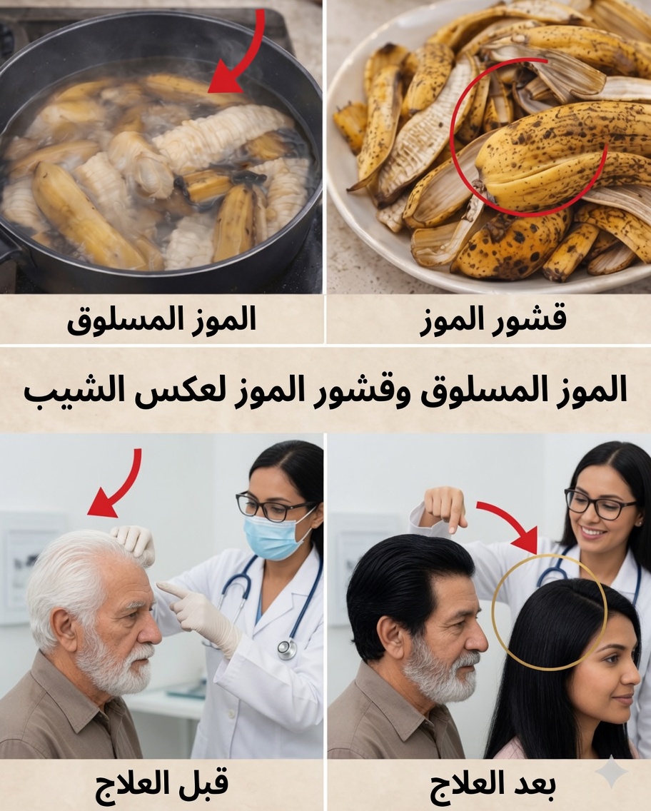 هل يعود الشعر الأبيض إلى الأسود طبيعيًا؟ الحقيقة حول قشر الموز لعكس الشيب وتحفيز نمو الشعر