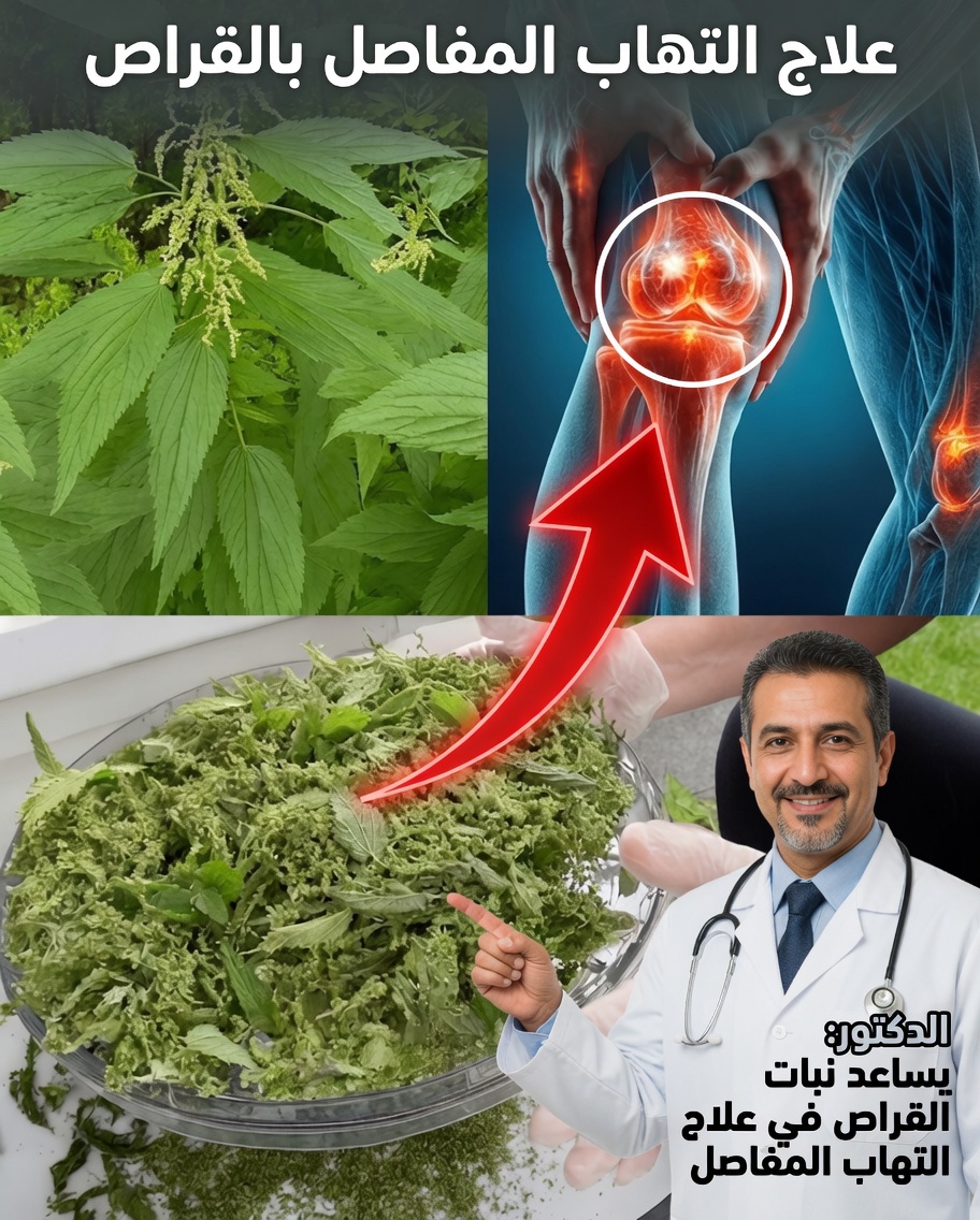 قوة نبات القراص (Urtica dioica): طريق طبيعي لتخفيف آلام المفاصل والتهاب المفاصل والالتهابات