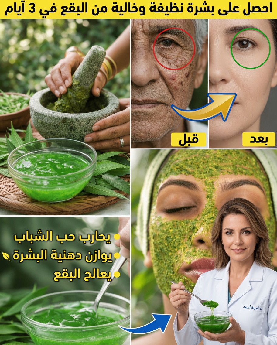 كيفية صنع واستخدام جل النيم المنزلي لبشرة أكثر صحة في المنزل