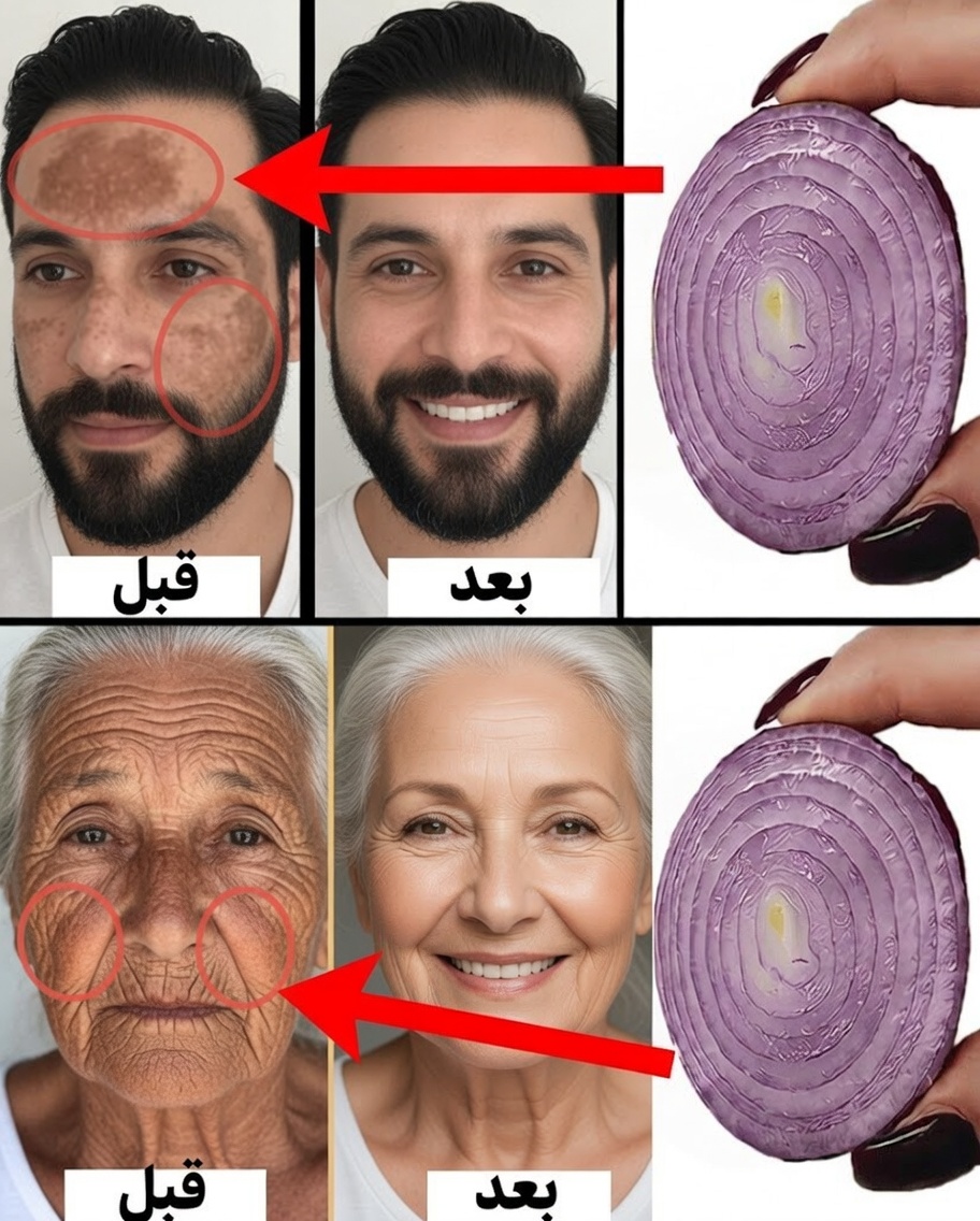 اخلطي نشا الذرة مع البصل لبشرة ناصعة البياض وصافية كالزجاج: سر طبيعي ستتمنين لو عرفته في وقت أبكر
