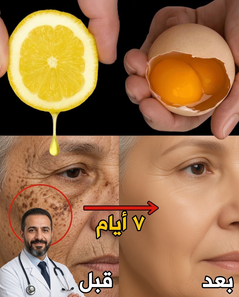 مزيج الليمون والبيض لبشرة شابة بشكل طبيعي