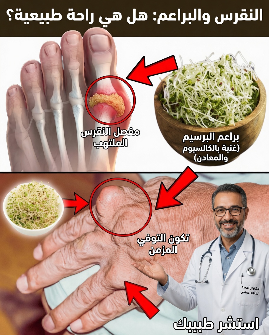 اكتشف القوة الخفية للبرسيم الحجازي: طريق طبيعي للتخفيف من حصوات الكلى والنقرس