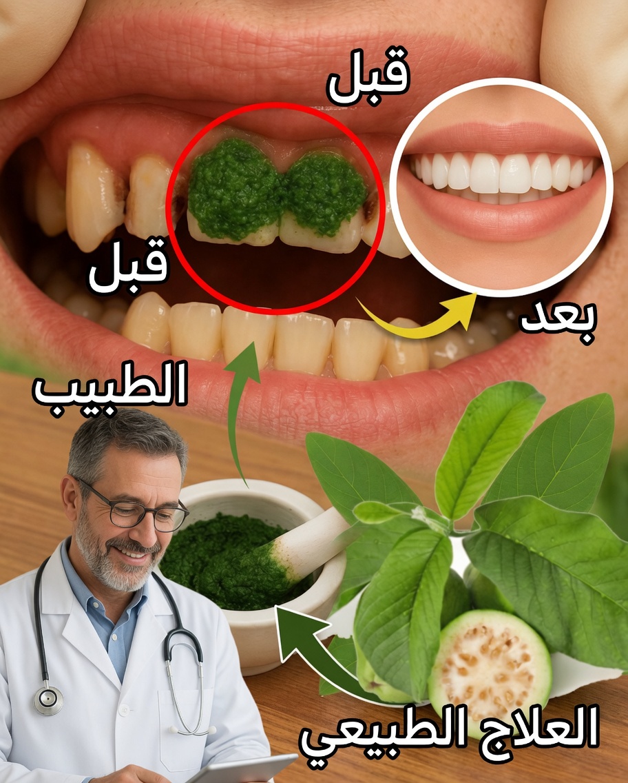 3 طرق قوية تُحارب بها أوراقُ الجوافة تسوّسَ الأسنان