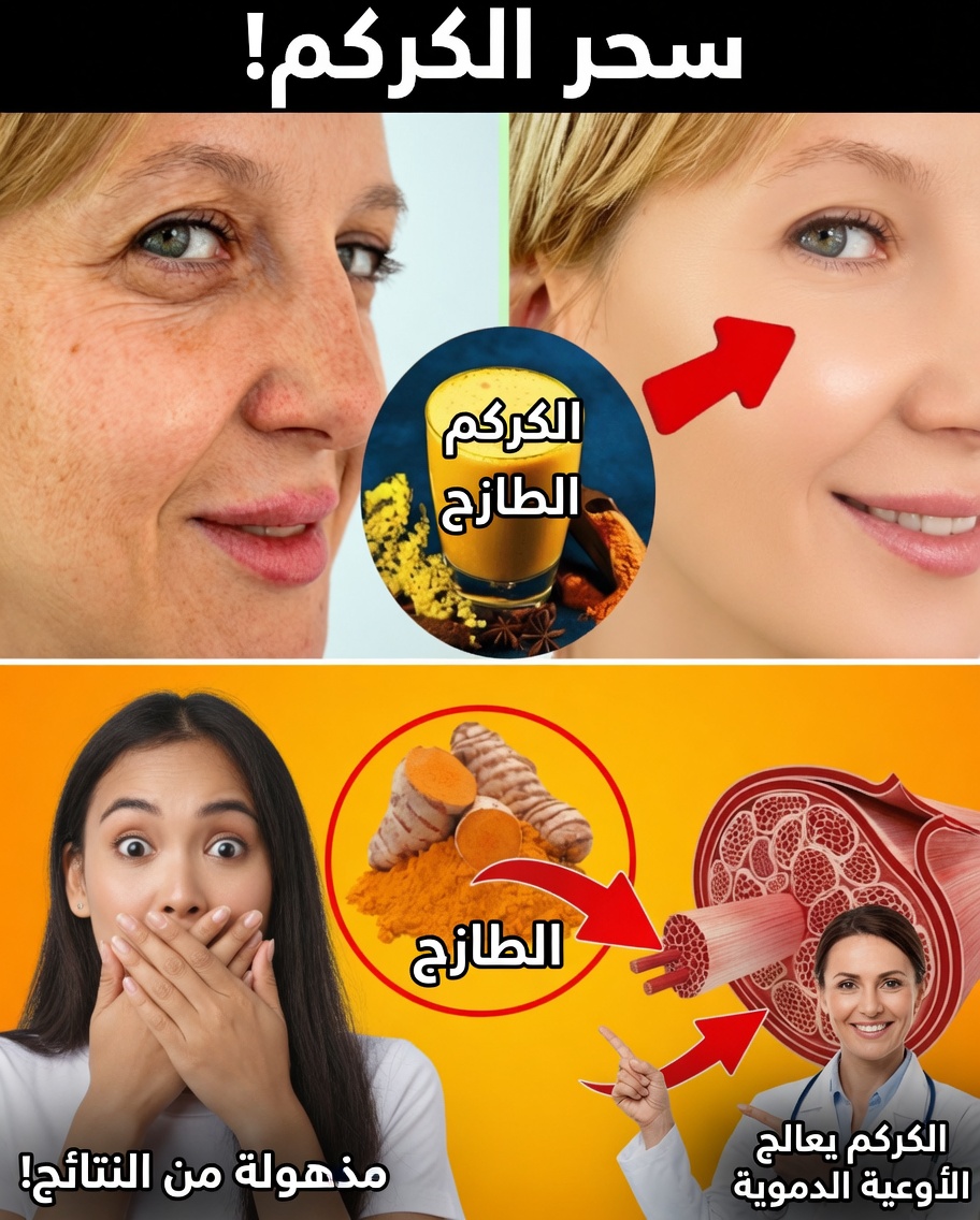 فوائد الكركم: 5 أسرار قليلة المعرفة لم تتخيلها أبدًا