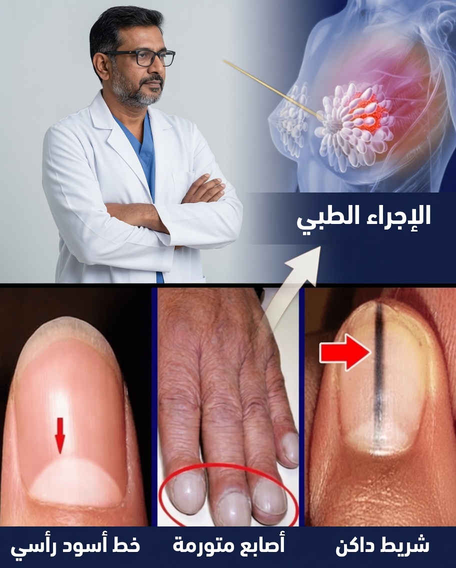 14 علامة تحذيرية صامتة للسرطان يجب على النساء ألا يتجاهلنها أبداً