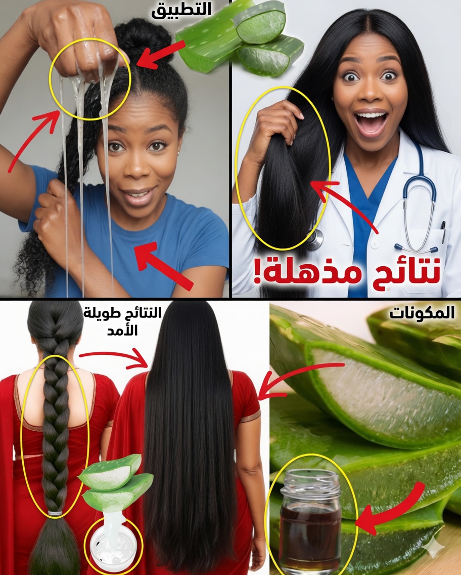 جل الألوفيرا والقرنفل المنزلي لتسريع نمو الشعر وزيادة كثافته وتحسين صحة فروة الرأس