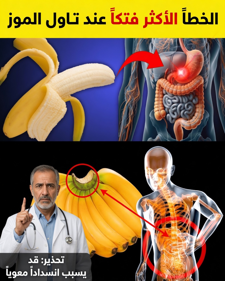 8 أخطاء خطيرة قد ترتكبها عند تناول الموز — وكيف تصلحها طبيعيًا