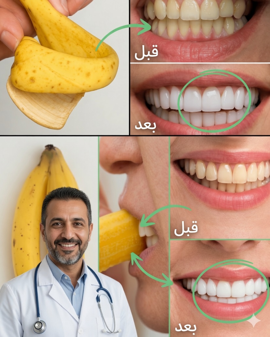 أضيئي ابتسامتكِ في دقيقتين فقط بقشرة موزة