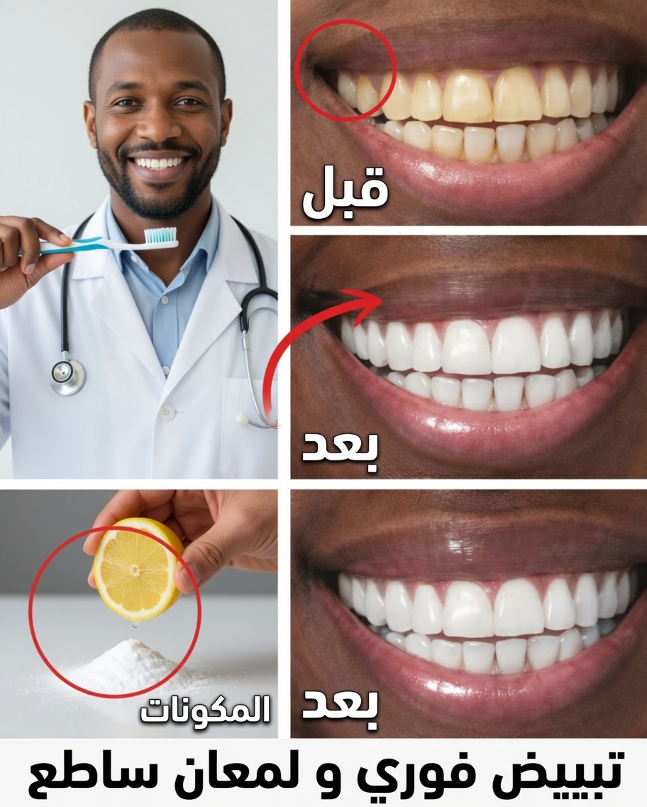 كيفية تبييض الأسنان المصفرّة طبيعيًا في المنزل: السر القوي للموز والزنجبيل والليمون الذي يلفت الانتباه