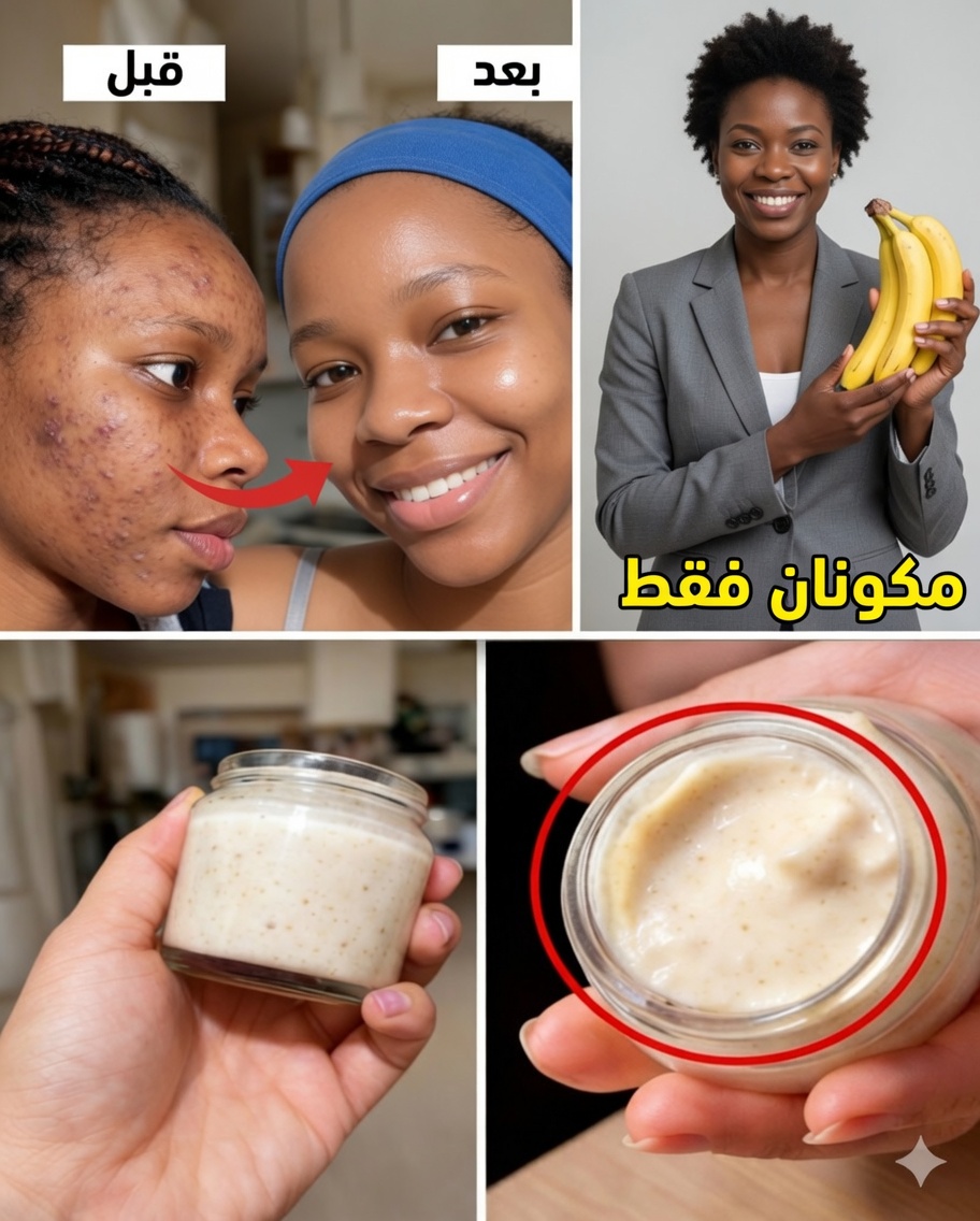 7 طرق طبيعية لتخفيف الخطوط الدقيقة وتفتيح البشرة باستخدام قشر الموز