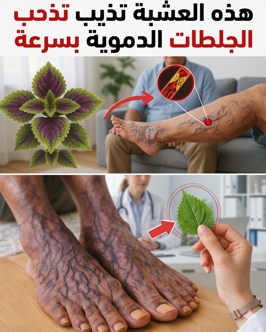 6 أعشاب قوية يمكن أن تساعد طبيعيًا على تحسين الدورة الدموية وتقليل خطر الجلطات