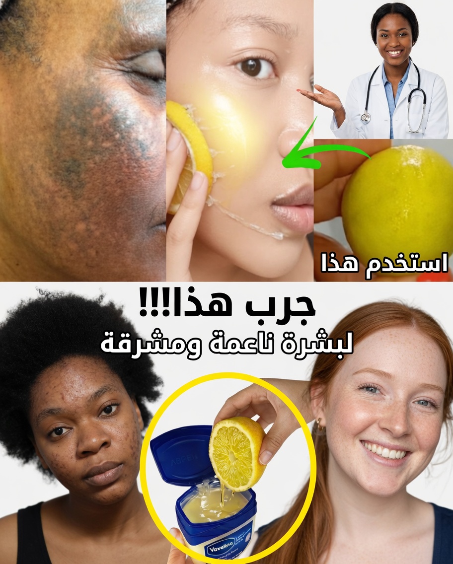 الفازلين والليمون لبشرة أكثر إشراقًا ونعومة