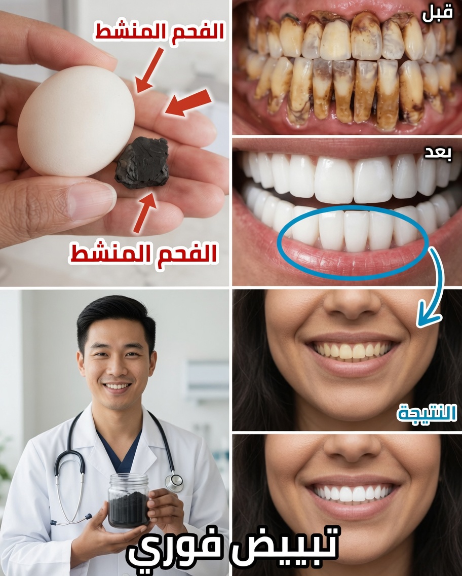 روتين بسيط لتنظيف الأسنان بالفرشاة لمدة 3 دقائق لتبييض الأسنان طبيعيًا في المنزل
