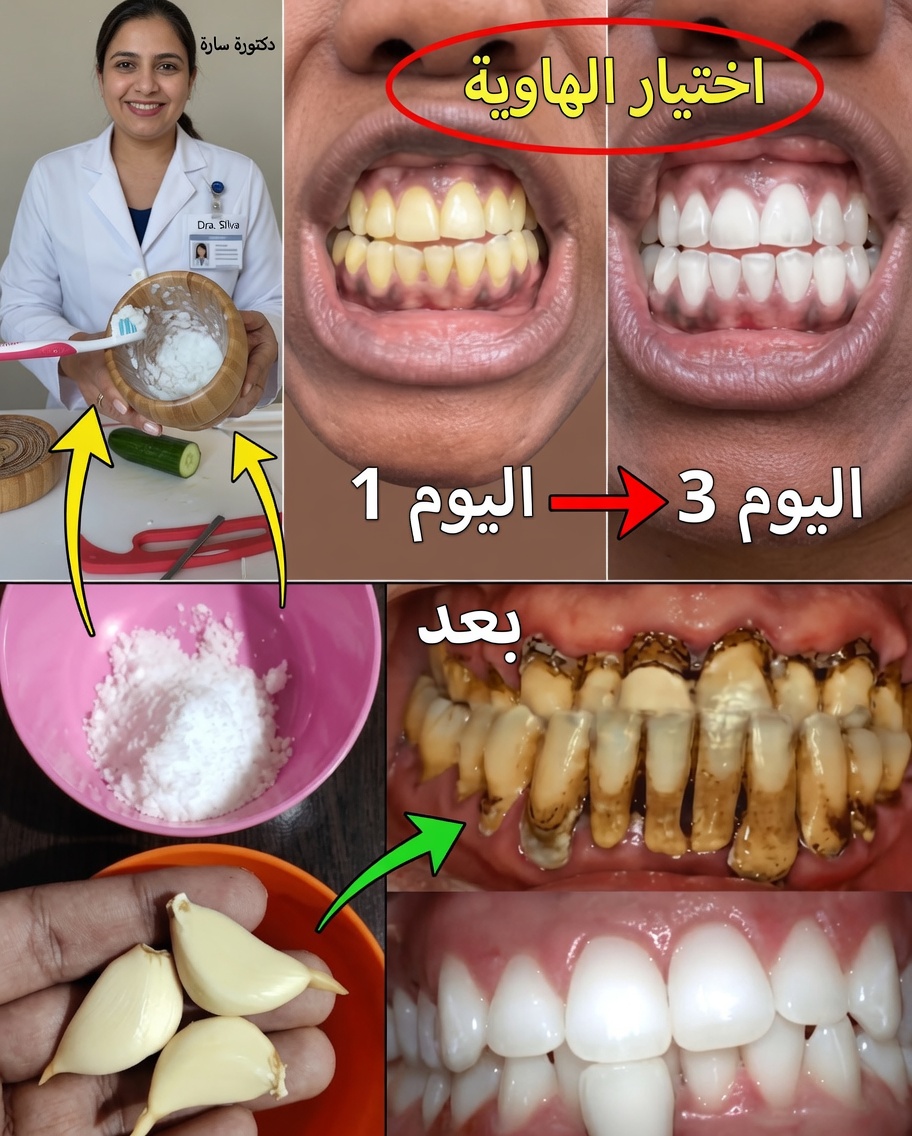 ابتسم كما لم تفعل من قبل: اكتشف أسرار ابتسامة مذهلة في المنزل