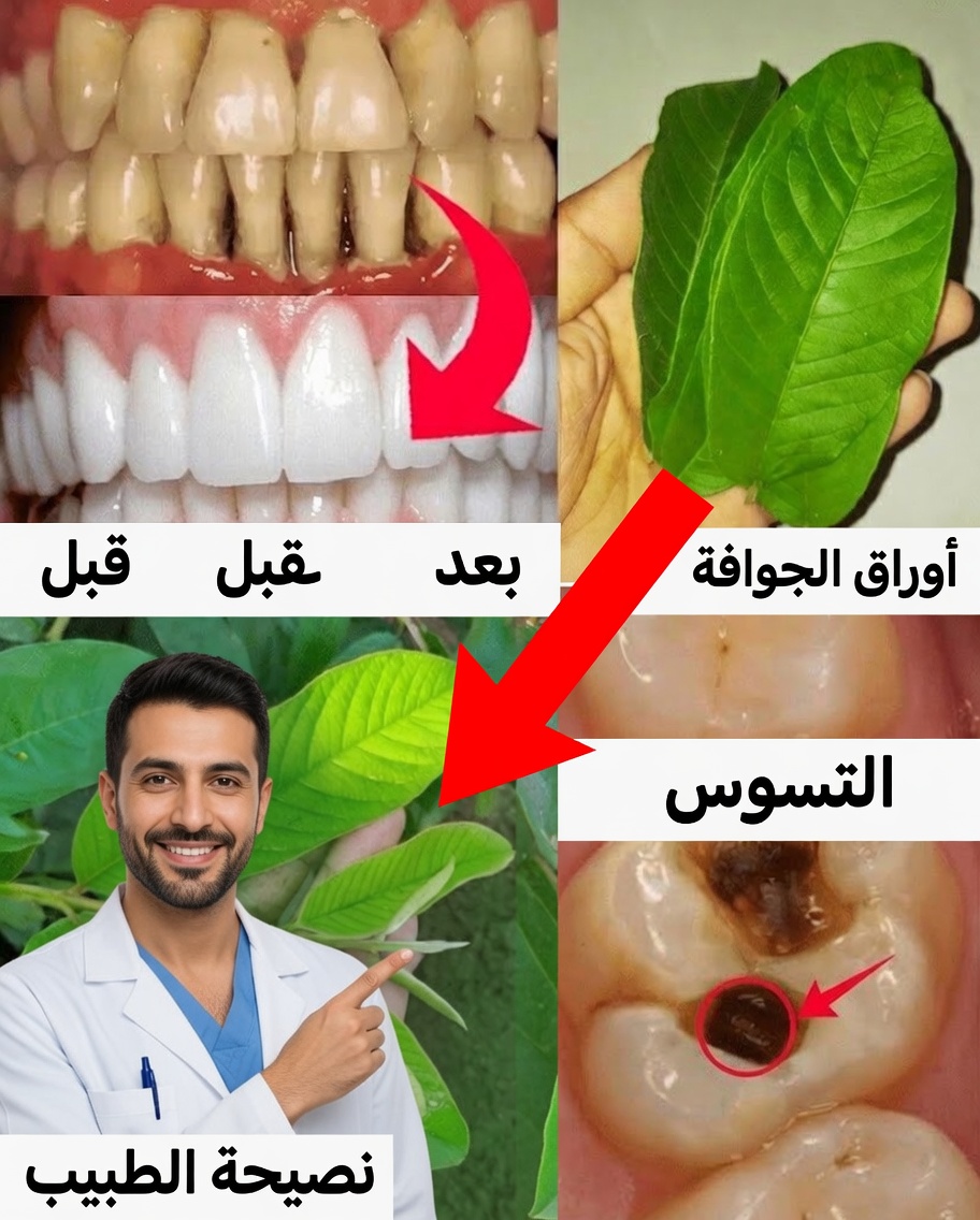 ٣ طرق بسيطة واقتصادية لعلاج تسوس الأسنان بأوراق الجوافة