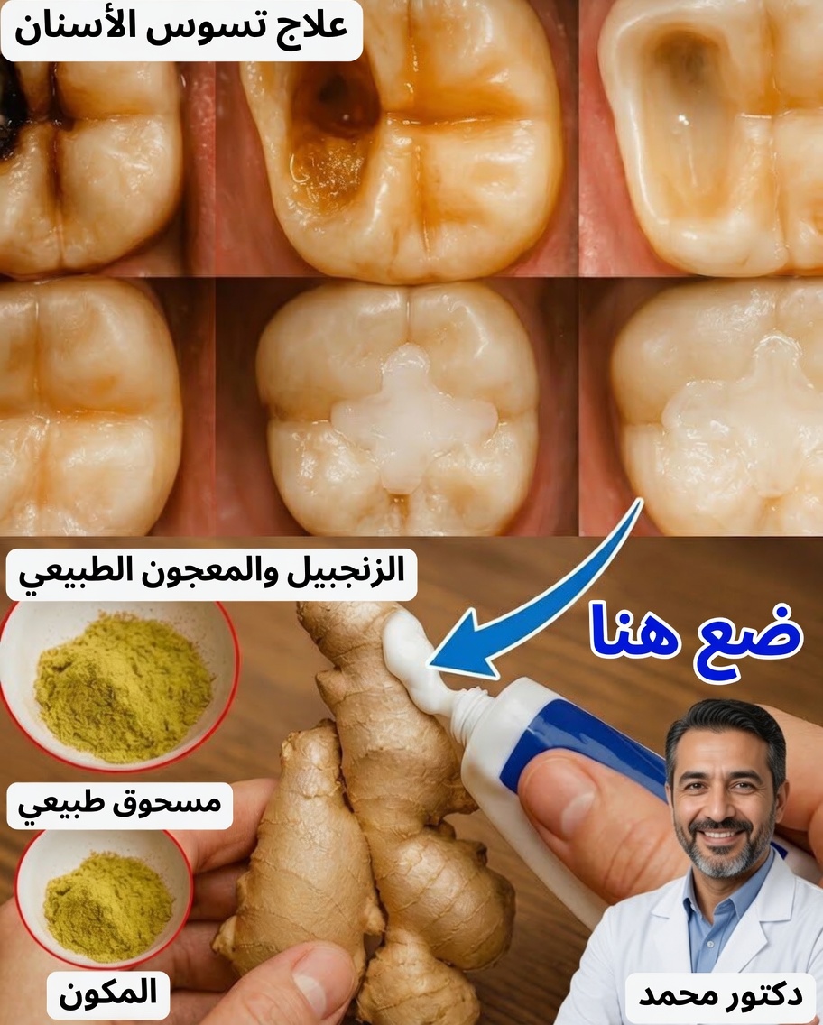 هل سئمت من تسوس الأسنان؟ اكتشف كيفية تقوية أسنانك طبيعيًا