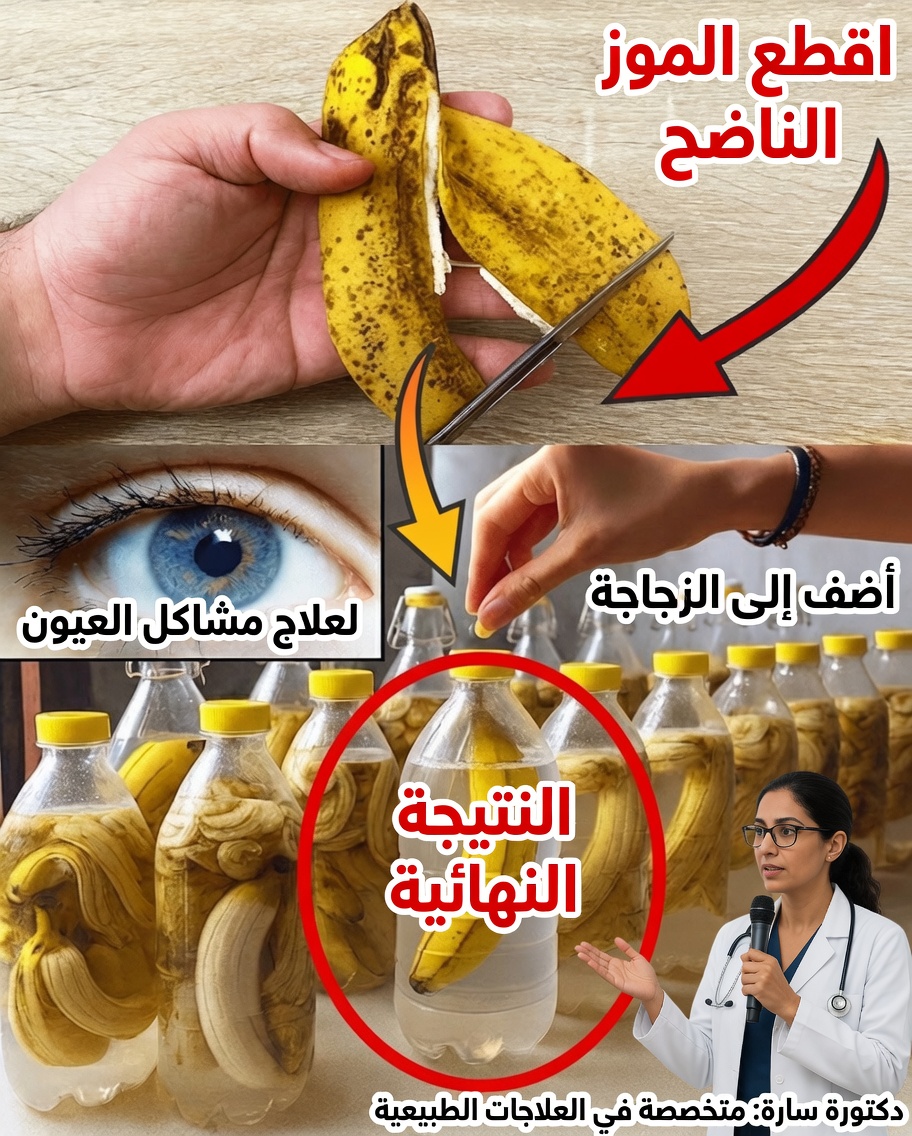 القوة السرية لقشور الموز مكشوفة