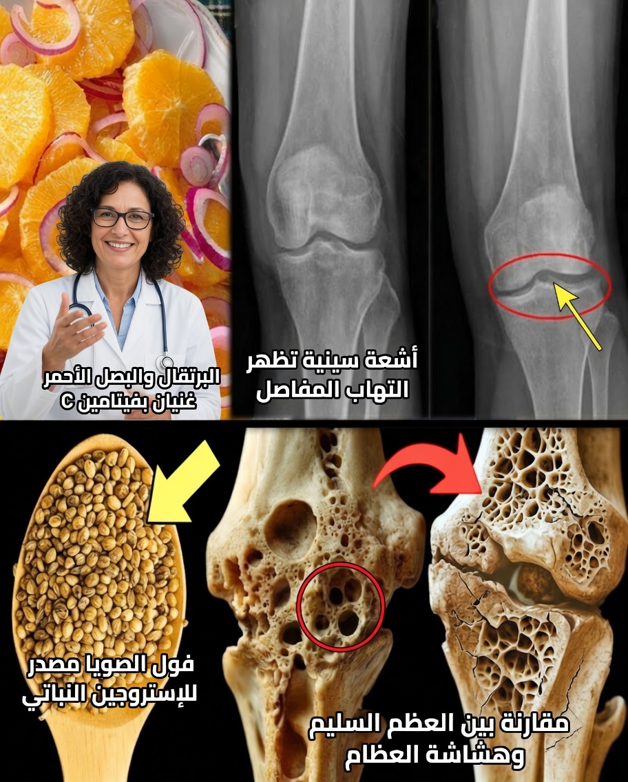 تحذير من هشاشة العظام: الطعام الطبيعي الوحيد الذي يمكن أن يساعد في تقوية العظام الضعيفة